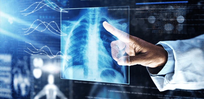 Better diagnosing diseases with the help of AI